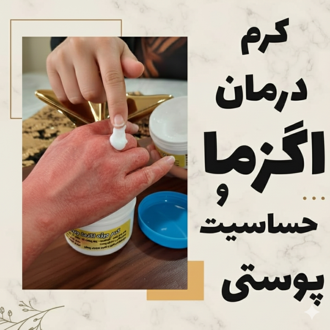 کرم درمان اگزما