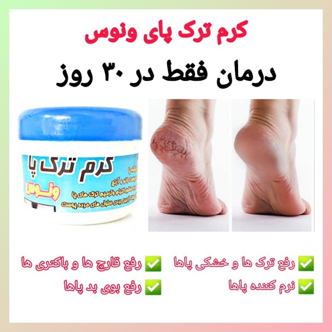 کرم ترک پای ونوس
